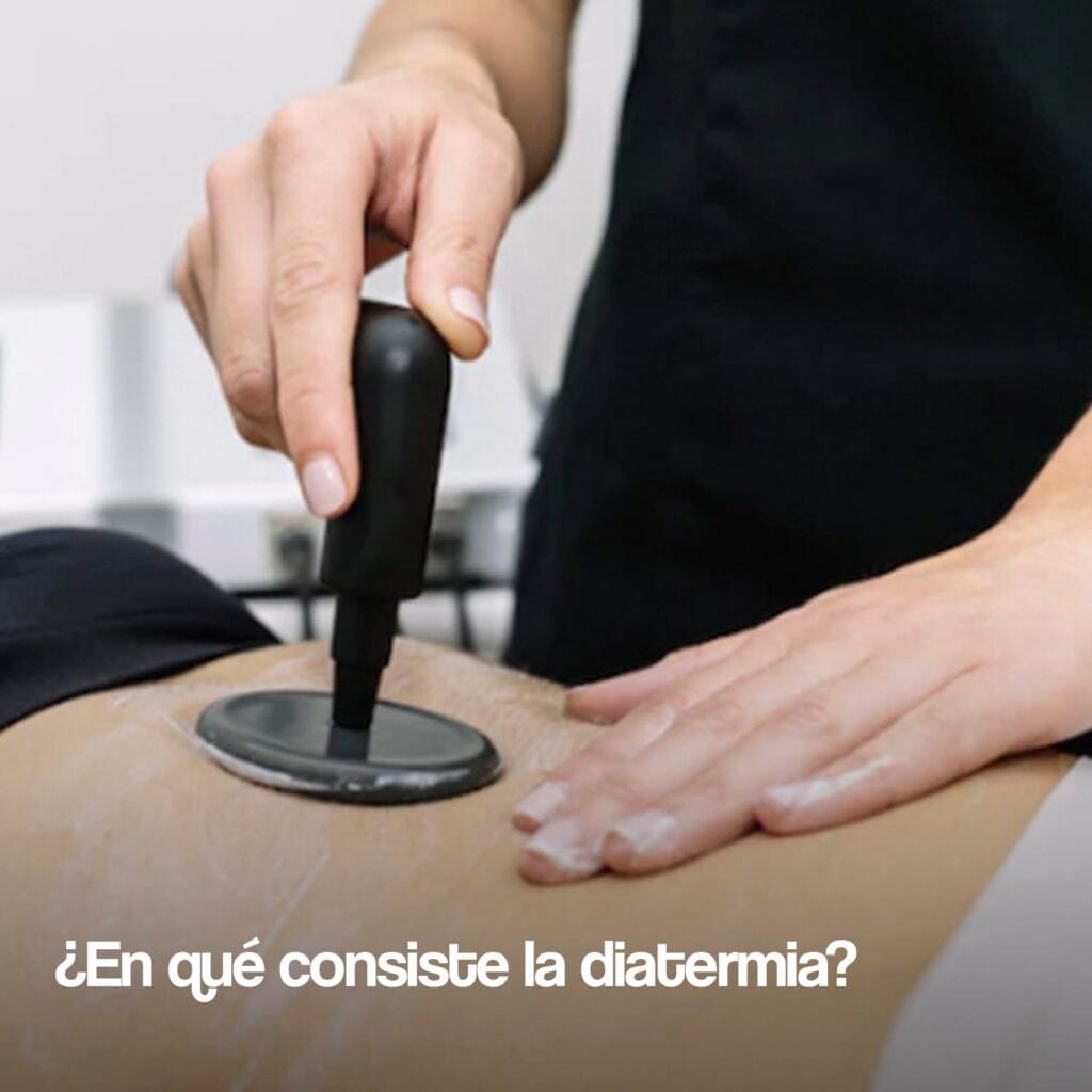 ¿En qué consiste la diatermia? diatermia